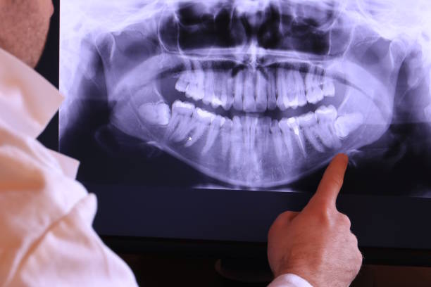 Best Dental Abscess Treatment in Gaithersburg, MD